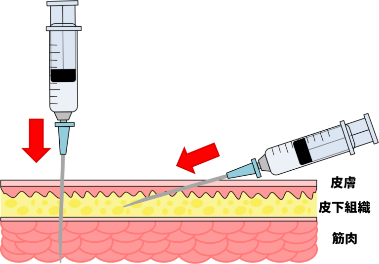 筋肉内注射 - Intramuscular injection - JapaneseClass.jp